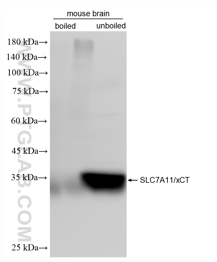 WB analysis of mouse brain using 82115-3-RR