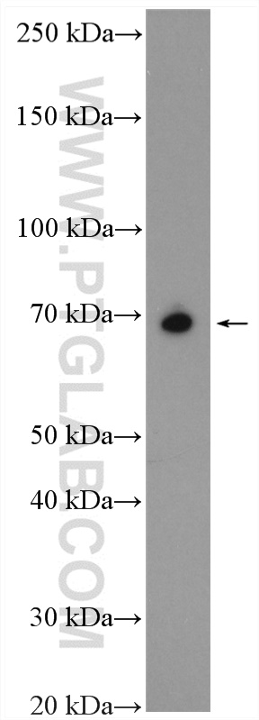 WB analysis of mouse brain using 15748-1-AP