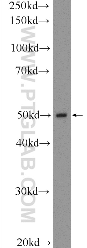 WB analysis of mouse lung using 13752-1-AP