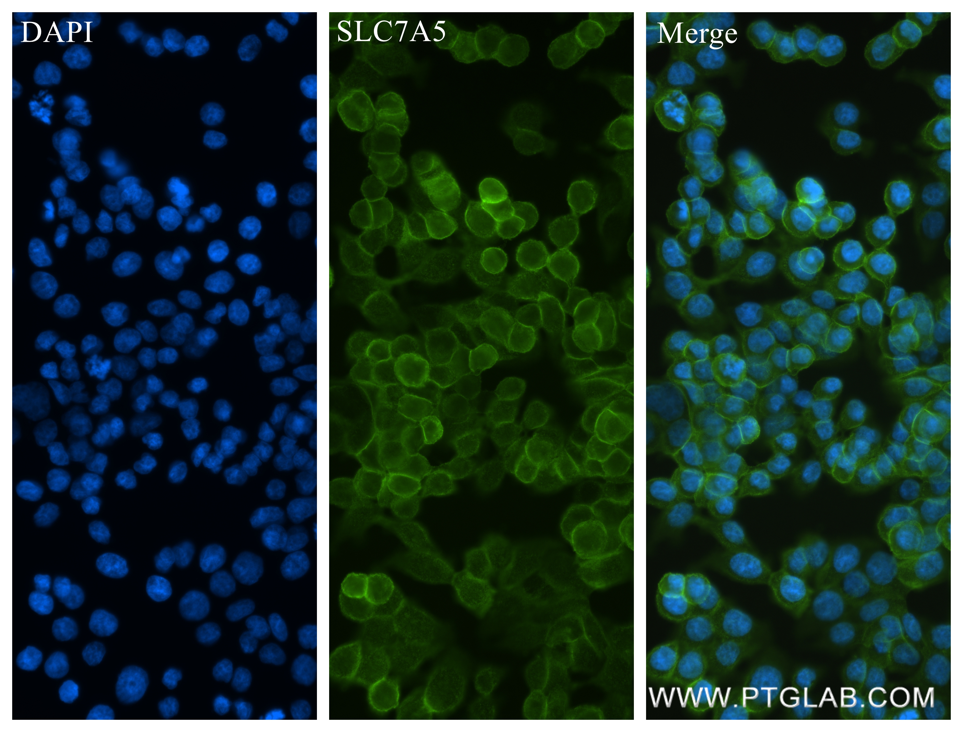 IF Staining of HT-29 using 84178-5-RR (same clone as 84178-5-PBS)
