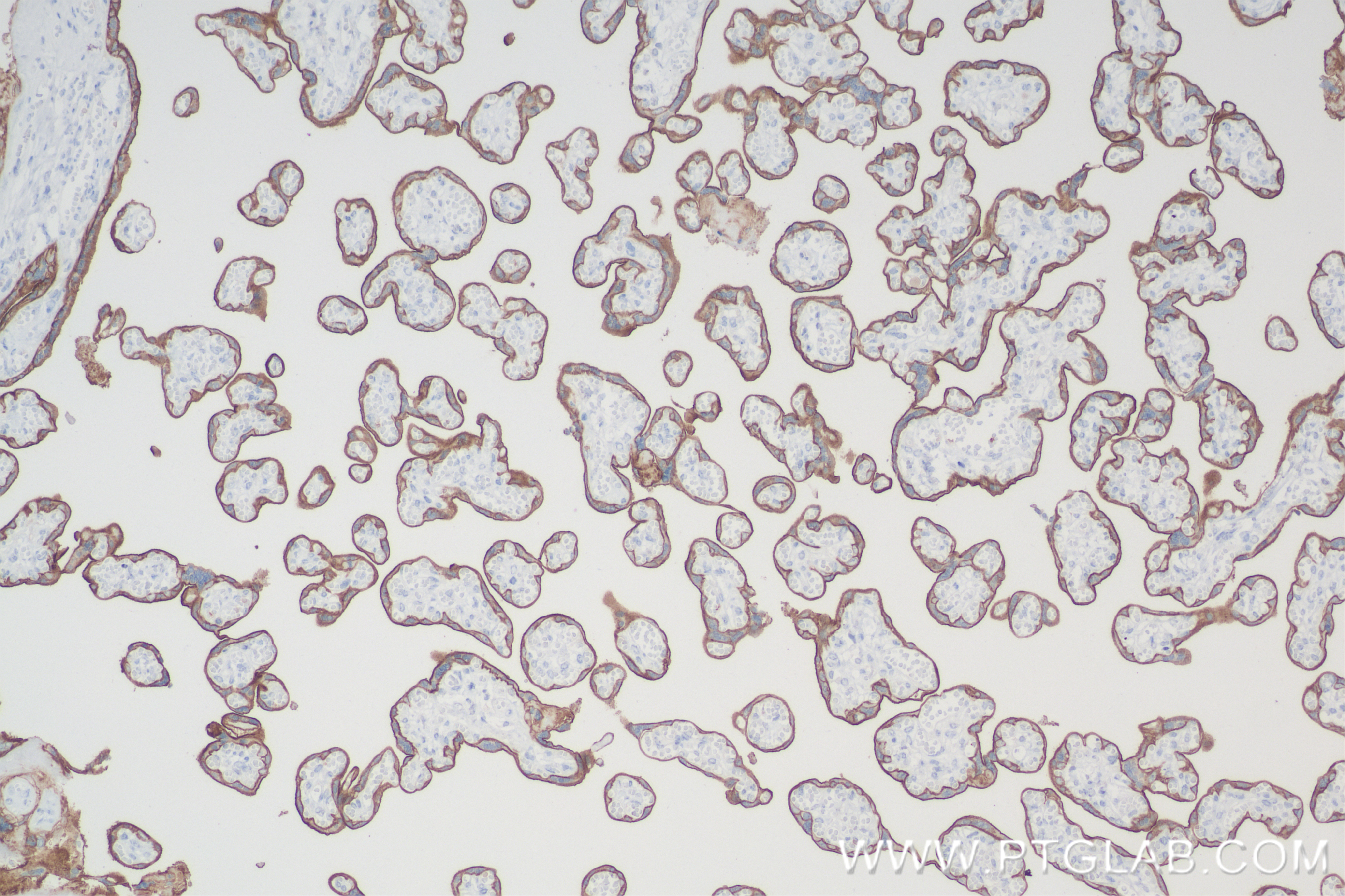 IHC staining of human placenta using 84178-5-RR (same clone as 84178-5-PBS)