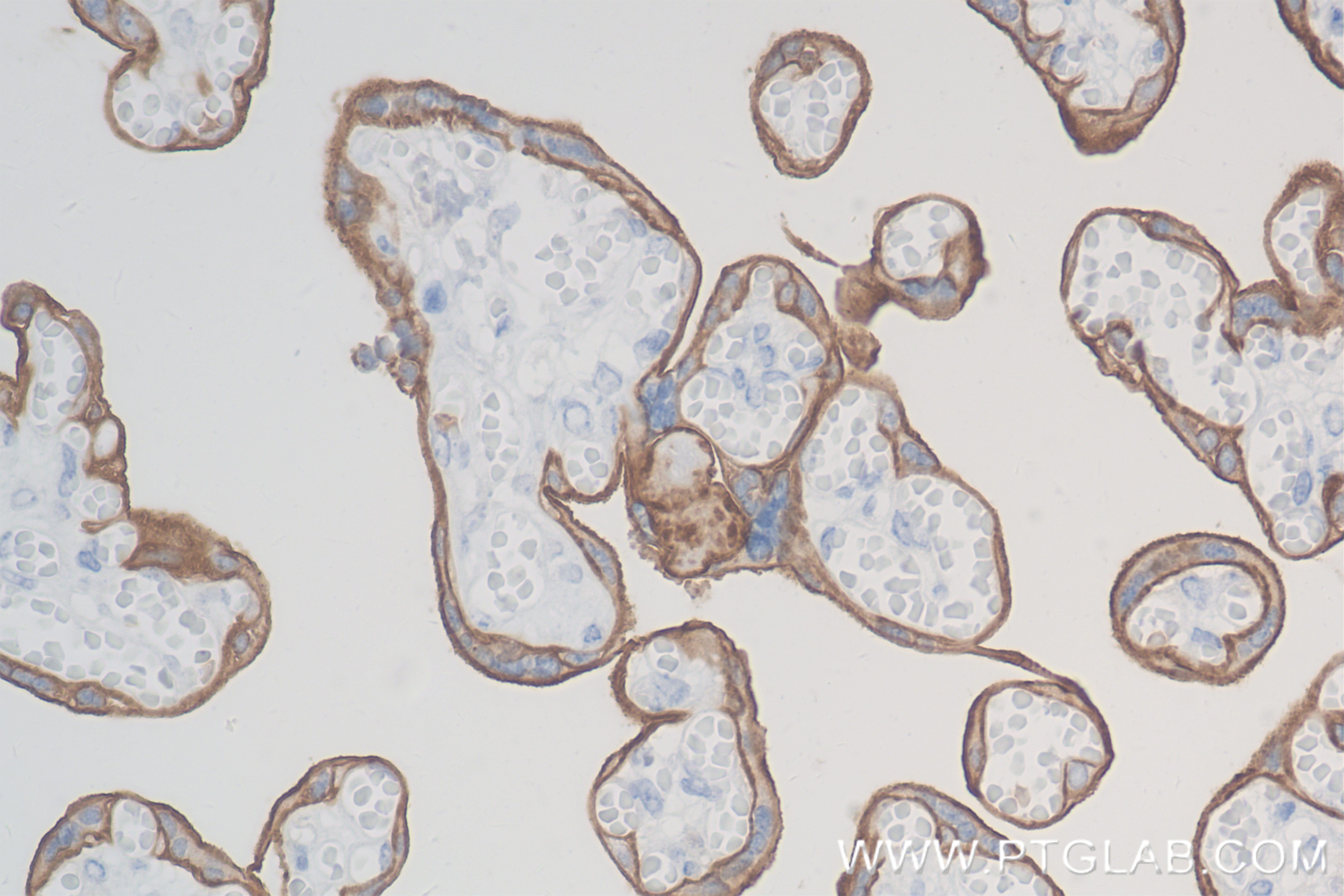 IHC staining of human placenta using 84178-5-RR (same clone as 84178-5-PBS)