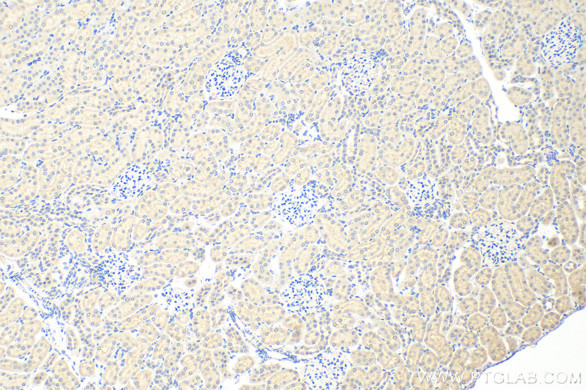 IHC staining of rat kidney using 31437-1-AP