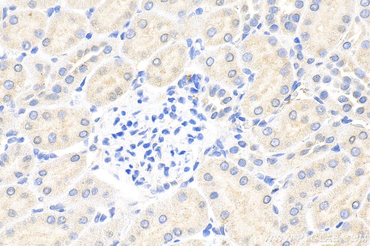 IHC staining of rat kidney using 31437-1-AP