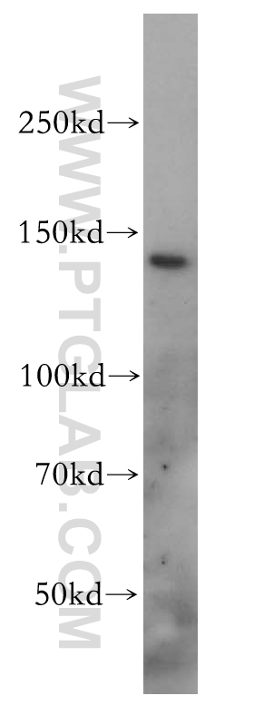 WB analysis of mouse liver using 17398-1-AP