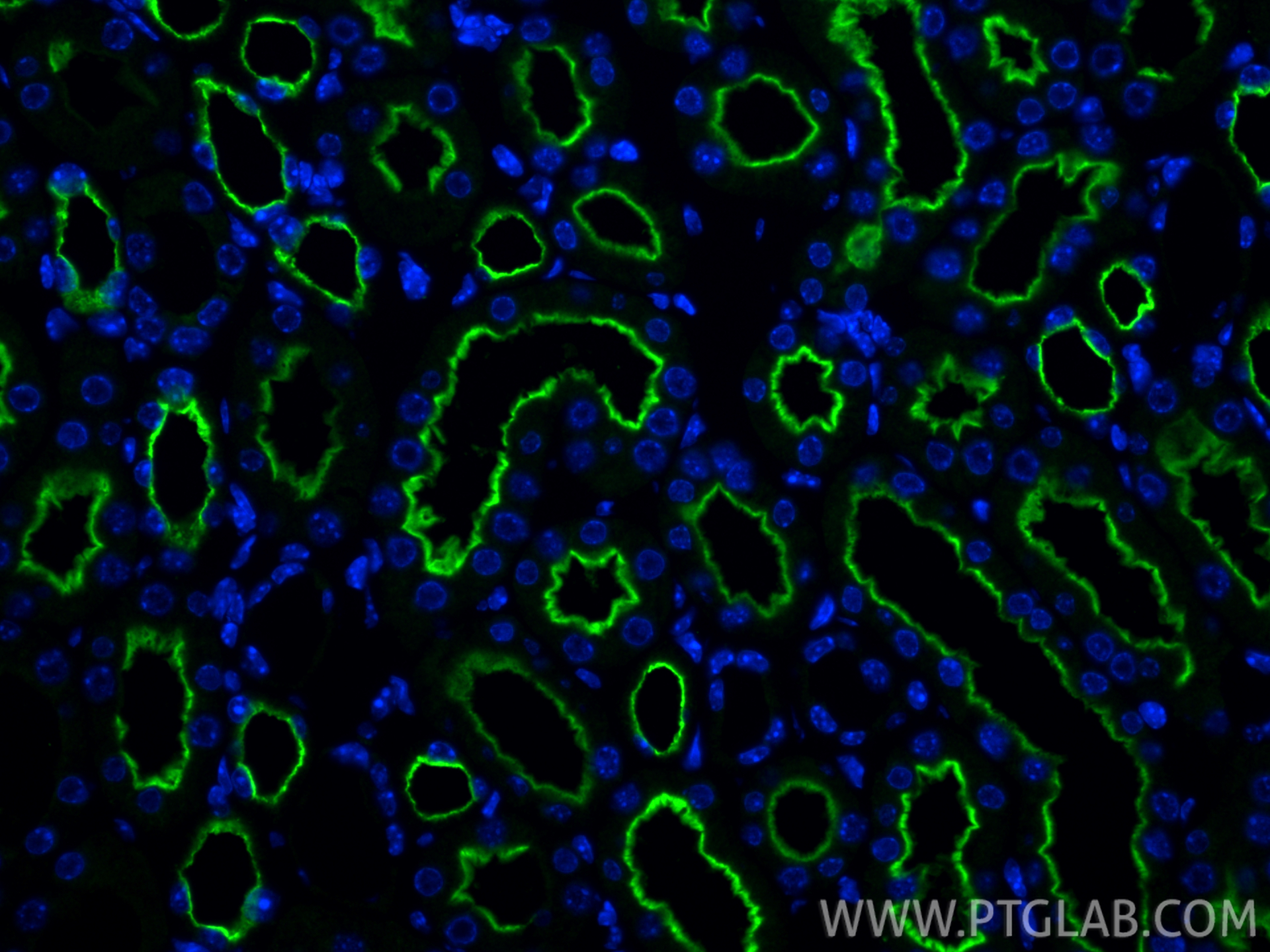 IF Staining of mouse kidney using 33559-1-AP