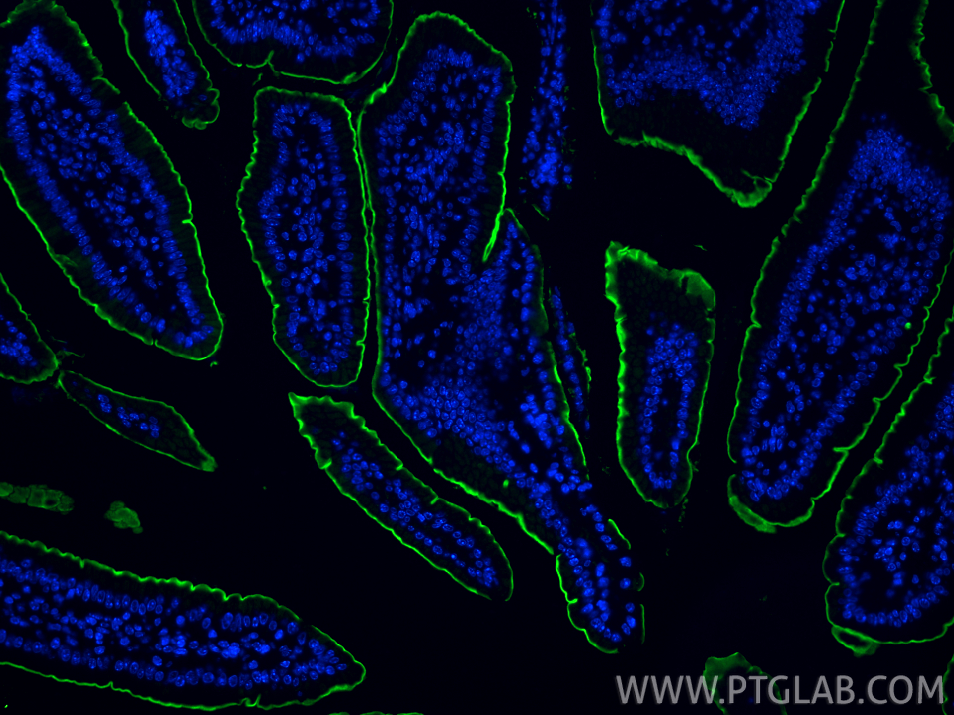 IF Staining of mouse small intestine using 33559-1-AP