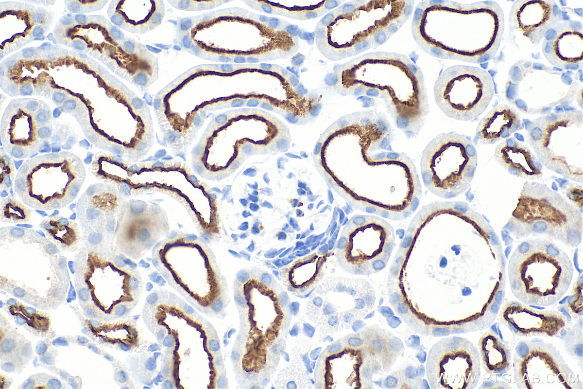 IHC staining of mouse kidney using 33559-1-AP