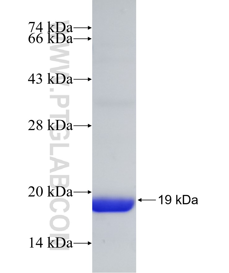 SLC9A3R1 fusion protein Ag30942 SDS-PAGE