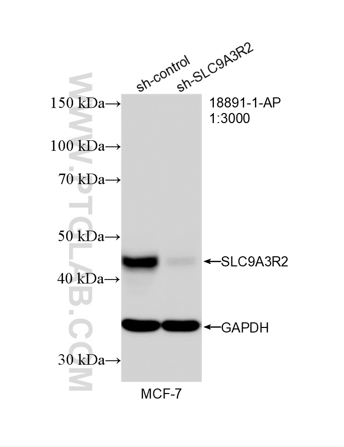 WB analysis of MCF-7 using 18891-1-AP WB analysis of MCF-7 using 18891-1-AP
