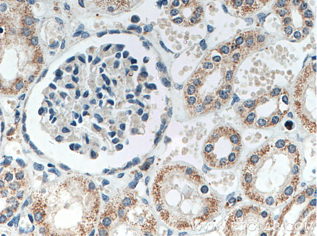 IHC staining of human kidney using 66577-1-Ig