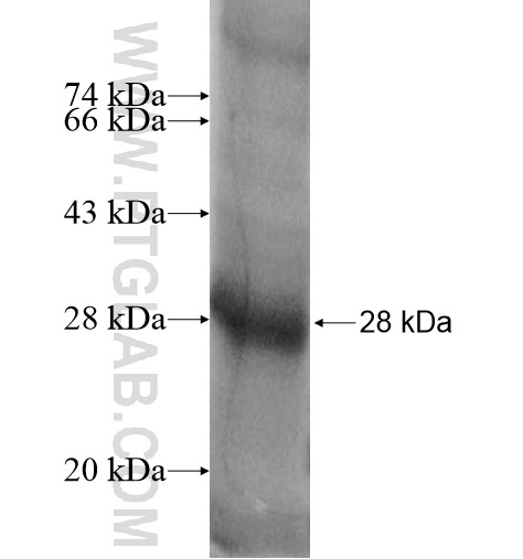 SLCO1A2 fusion protein Ag13566 SDS-PAGE SLCO1A2 fusion protein Ag13566 SDS-PAGE