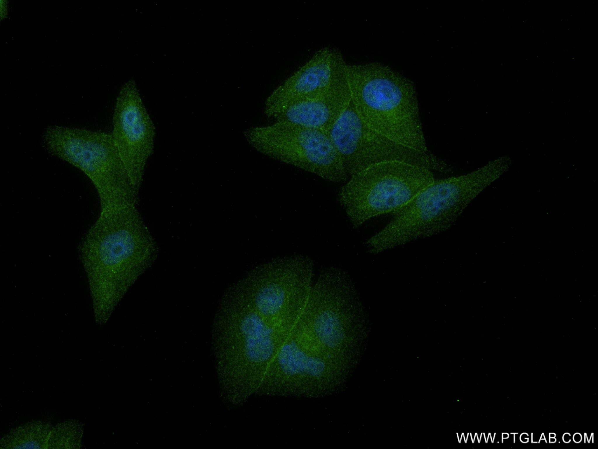 IF Staining of HepG2 using 83054-5-RR (same clone as 83054-5-PBS)