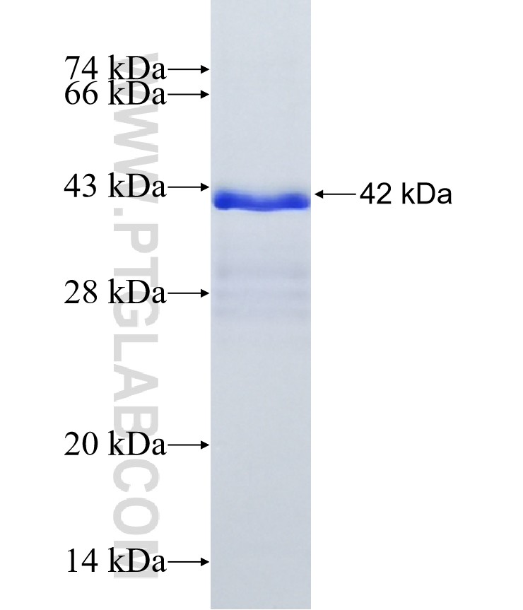 SLCO1B1 fusion protein Ag16545 SDS-PAGE SLCO1B1 fusion protein Ag16545 SDS-PAGE