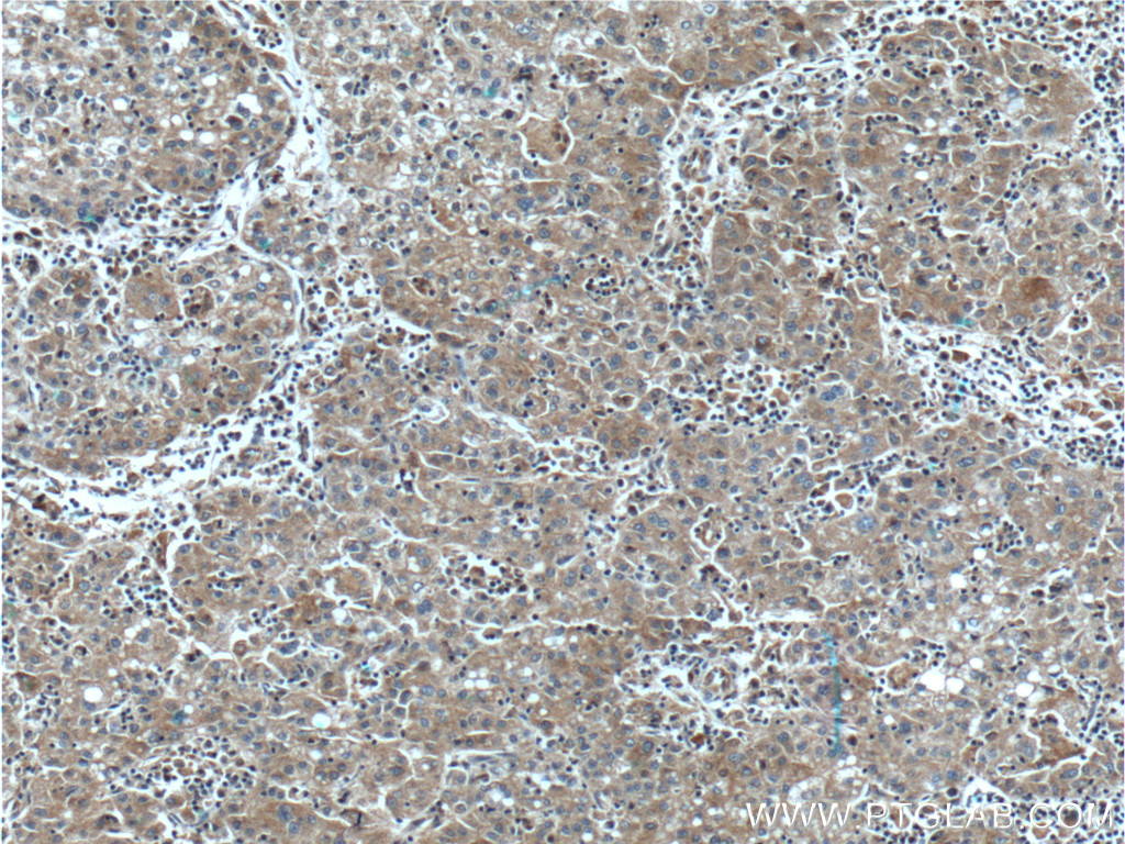 SLCO1B3/OATP1B3