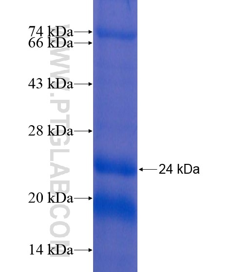 SLCO3A1 fusion protein Ag20379 SDS-PAGE SLCO3A1 fusion protein Ag20379 SDS-PAGE
