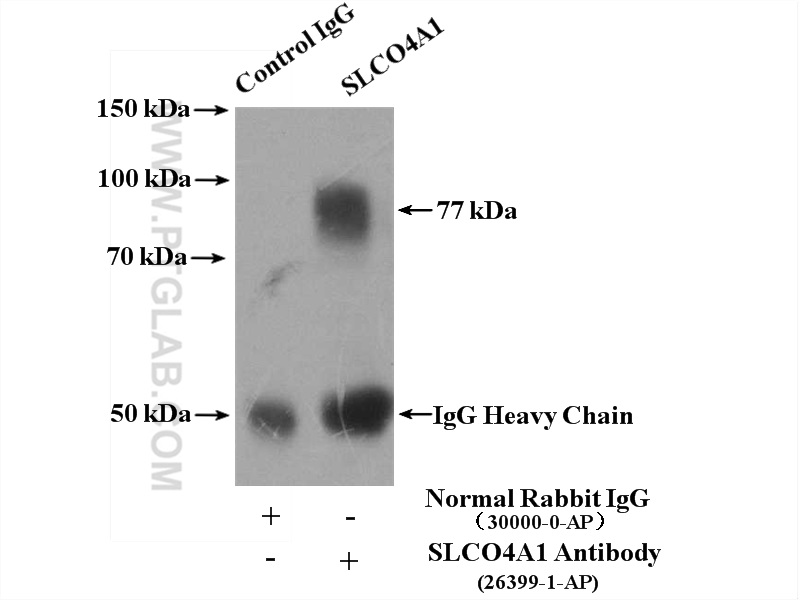 SLCO4A1