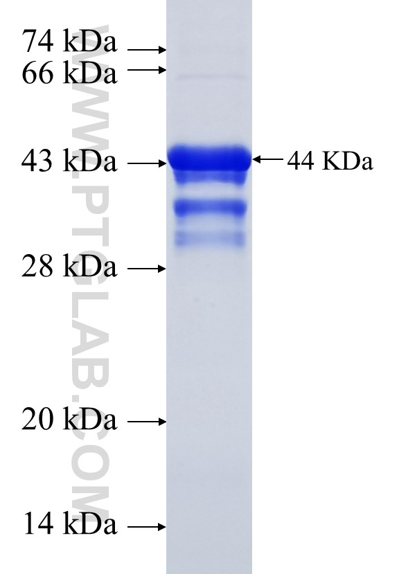 SLCO5A1 fusion protein Ag22652 SDS-PAGE SLCO5A1 fusion protein Ag22652 SDS-PAGE