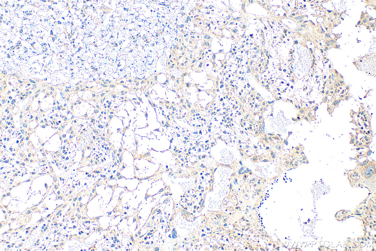 IHC staining of mouse placenta using 30550-1-AP IHC staining of mouse placenta using 30550-1-AP