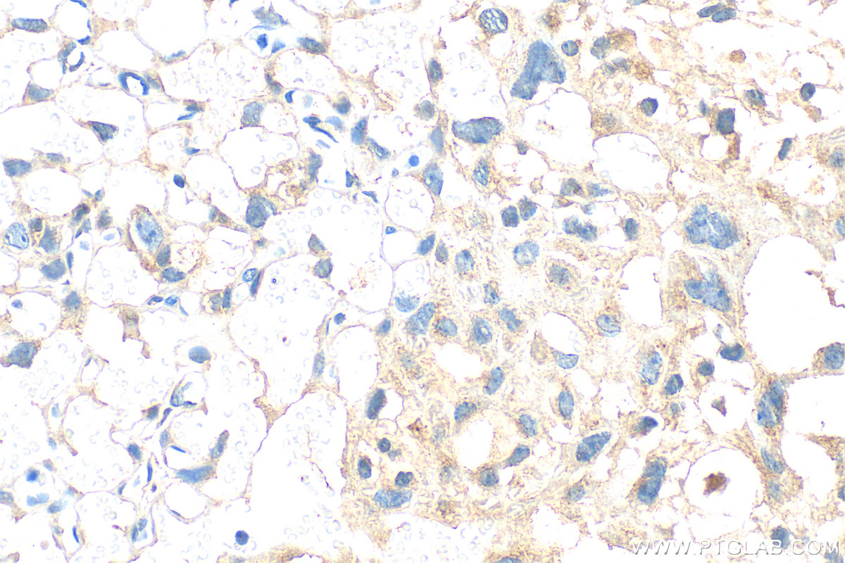 IHC staining of mouse placenta using 30550-1-AP IHC staining of mouse placenta using 30550-1-AP