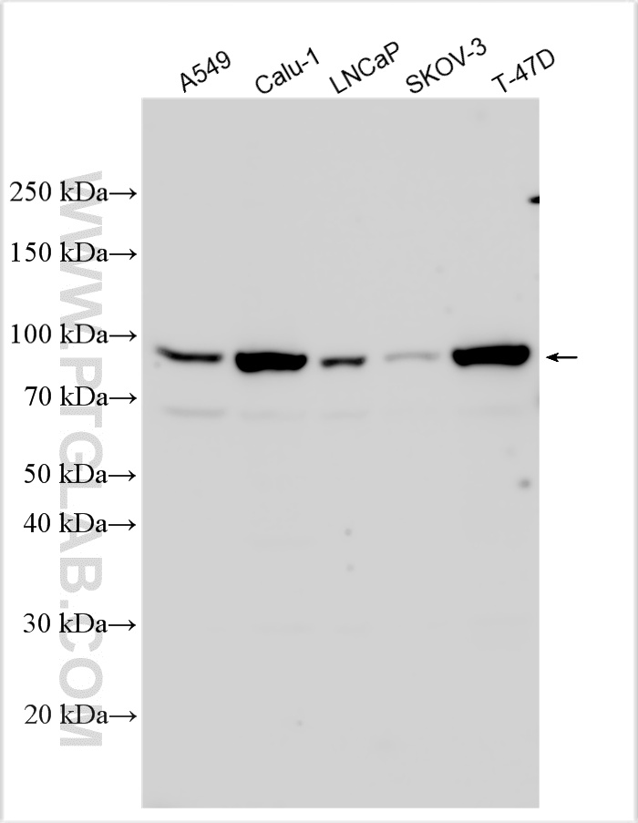 WB analysis using 16581-1-AP