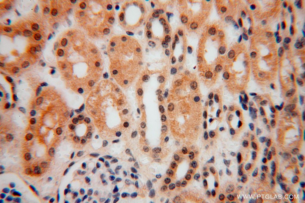 IHC staining of human kidney using 17065-1-AP