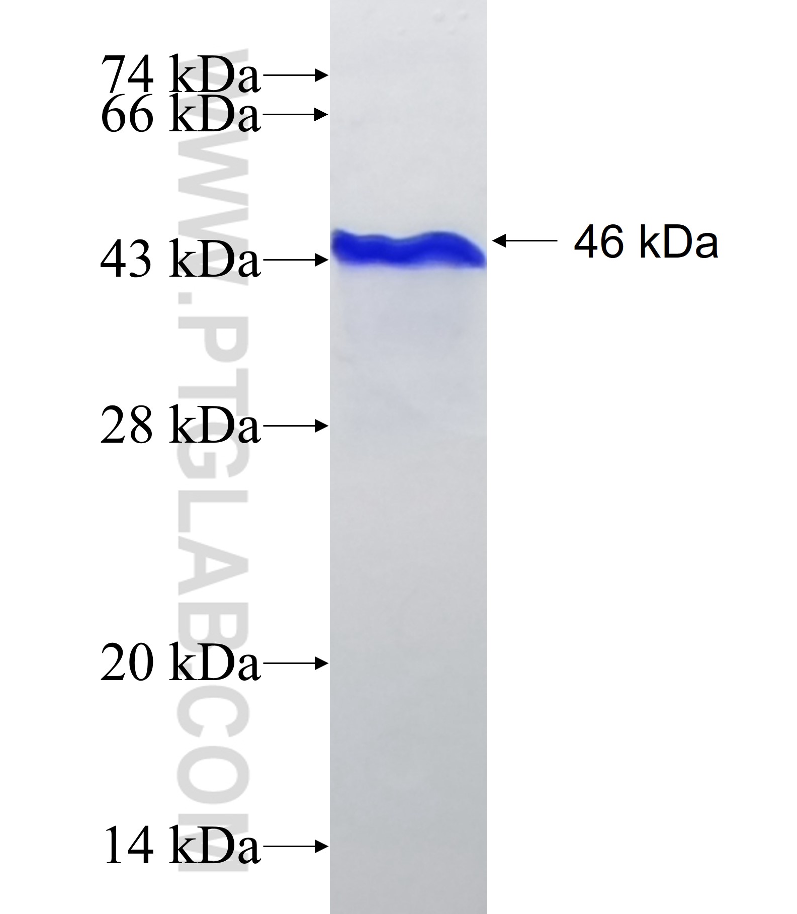 SLIT1 fusion protein Ag26451 SDS-PAGE SLIT1 fusion protein Ag26451 SDS-PAGE