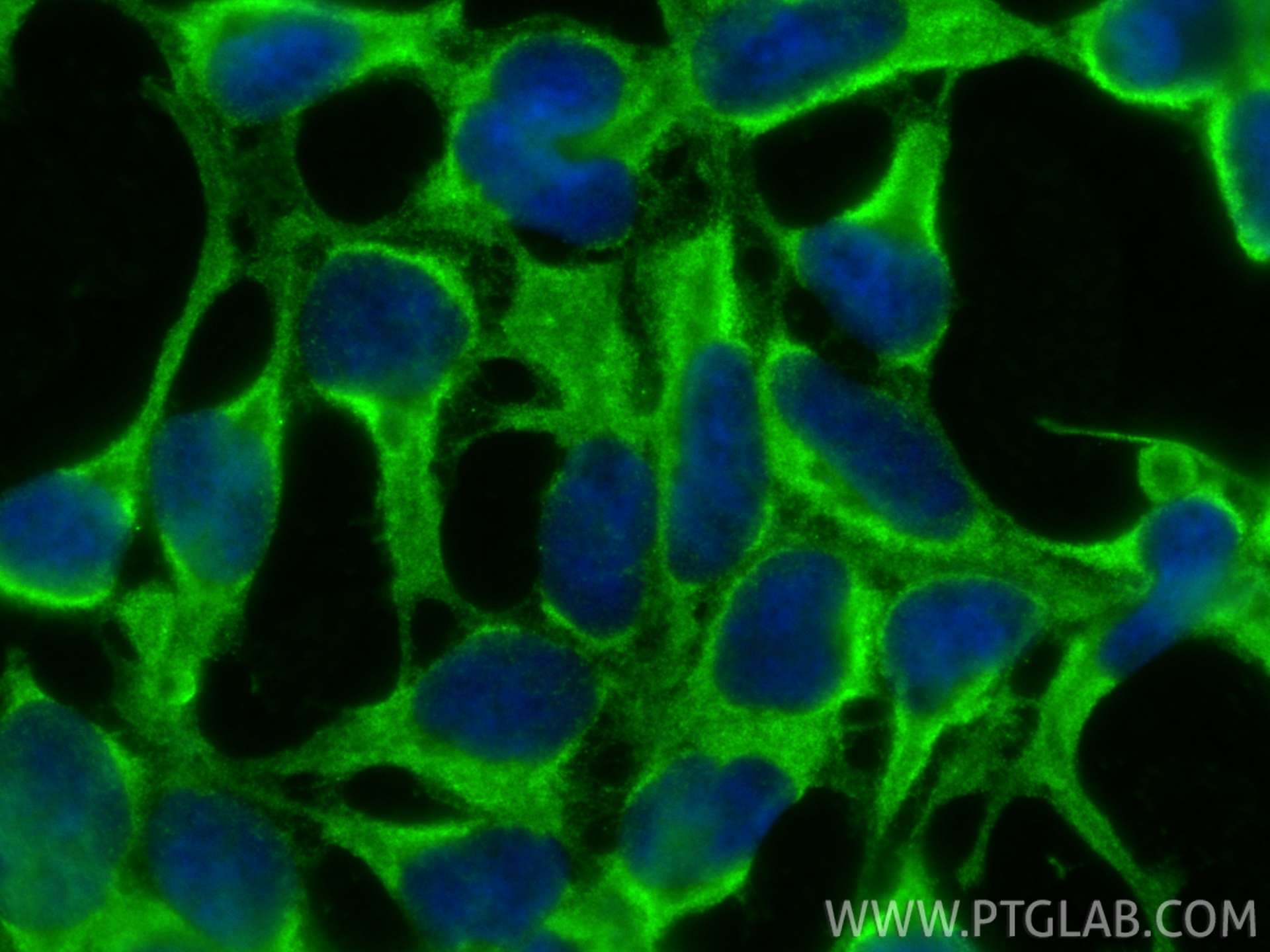 IF Staining of HEK-293 using 20217-1-AP