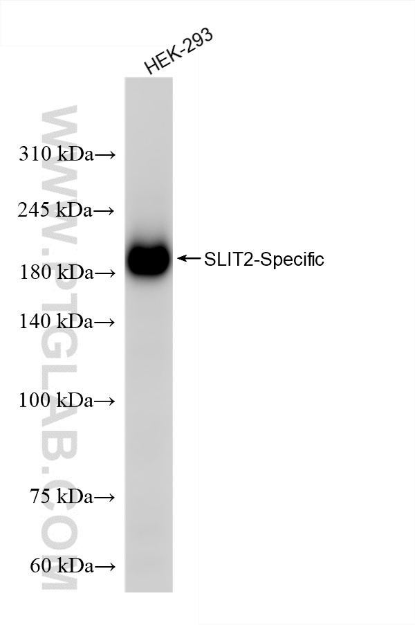 WB analysis of HEK-293 using 82725-4-RR (same clone as 82725-4-PBS)