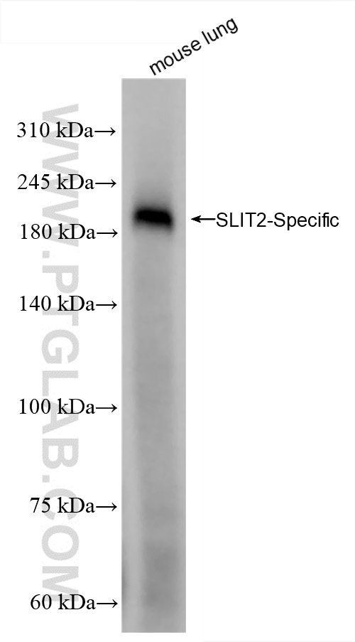WB analysis of mouse lung using 82725-4-RR (same clone as 82725-4-PBS)