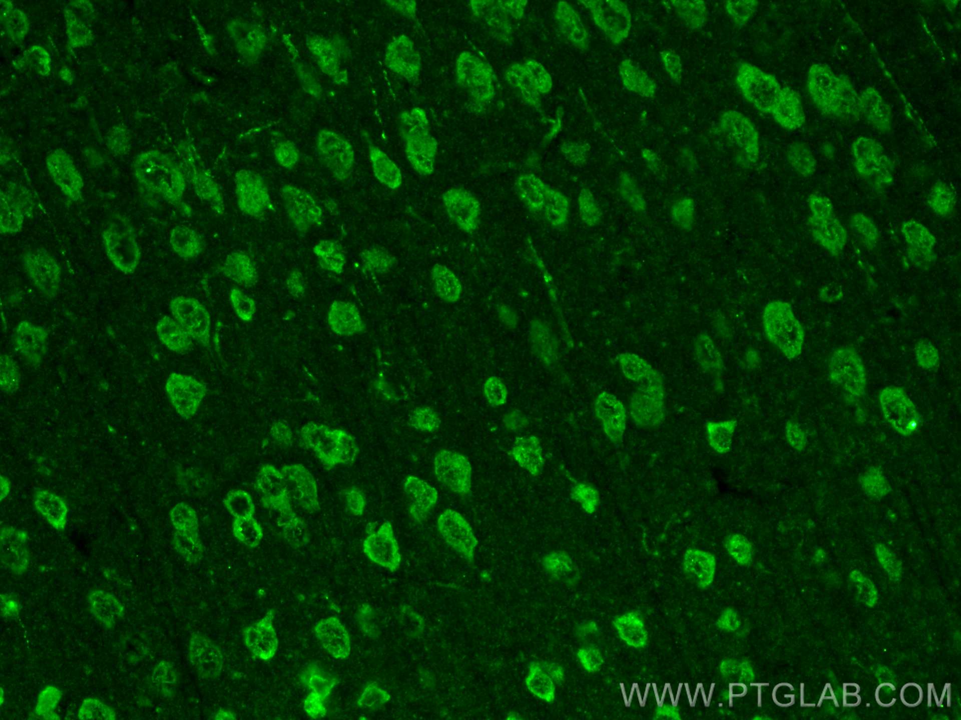 IF Staining of mouse brain using 21119-1-AP