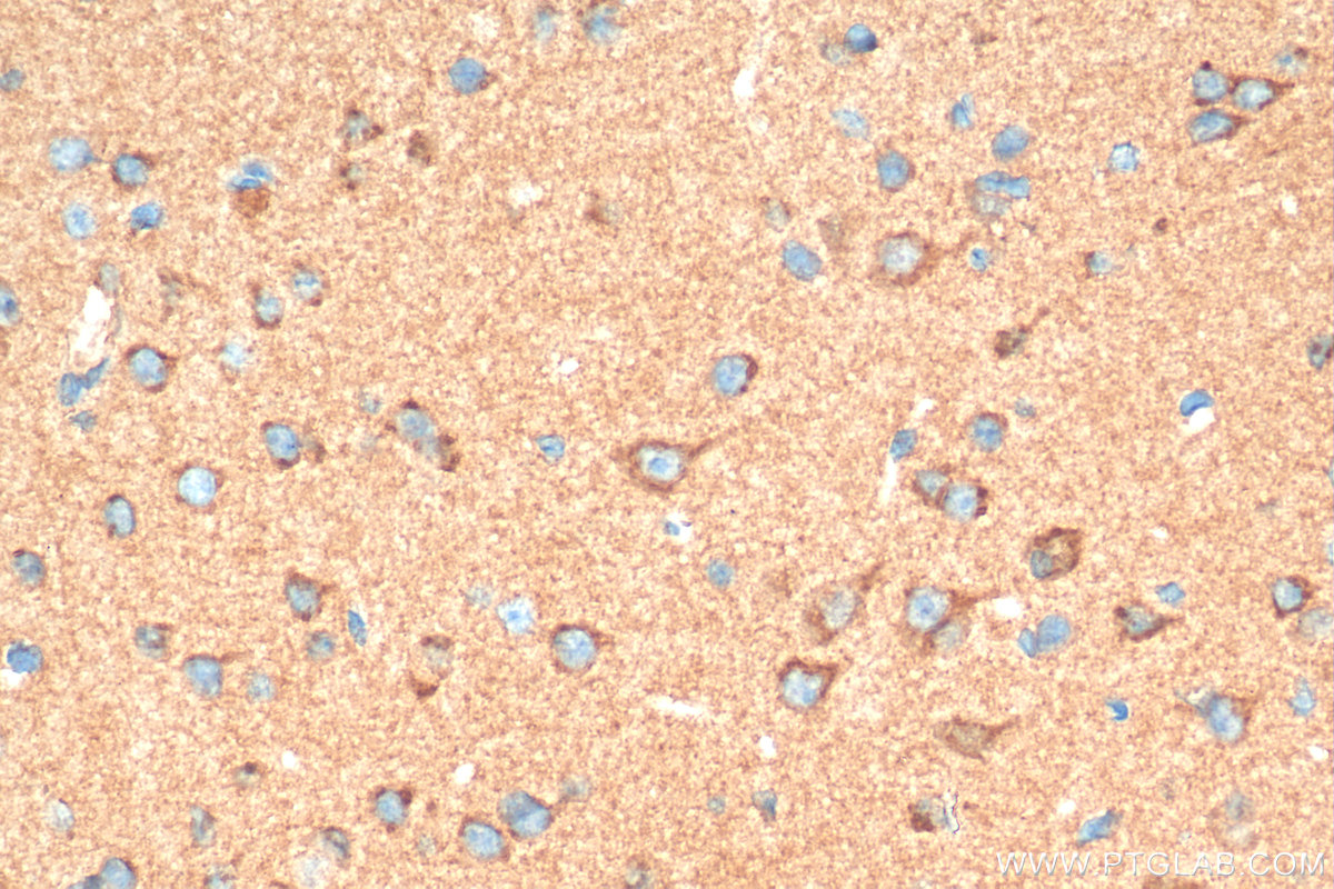 IHC staining of mouse brain using 21119-1-AP