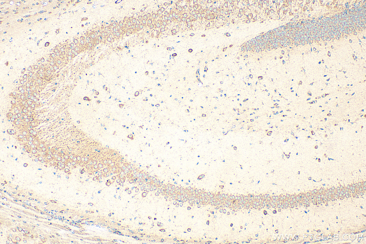 IHC staining of mouse brain using 21508-1-AP