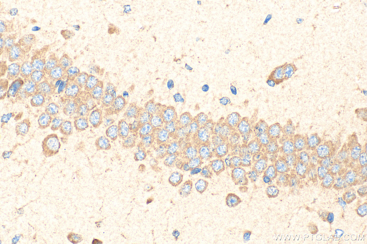 IHC staining of mouse brain using 21508-1-AP