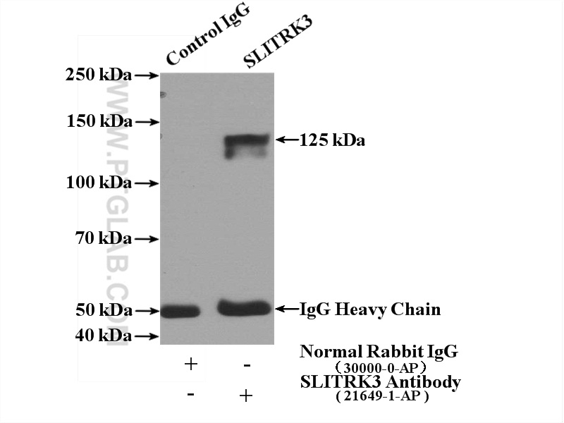 IP experiment of mouse brain using 21649-1-AP