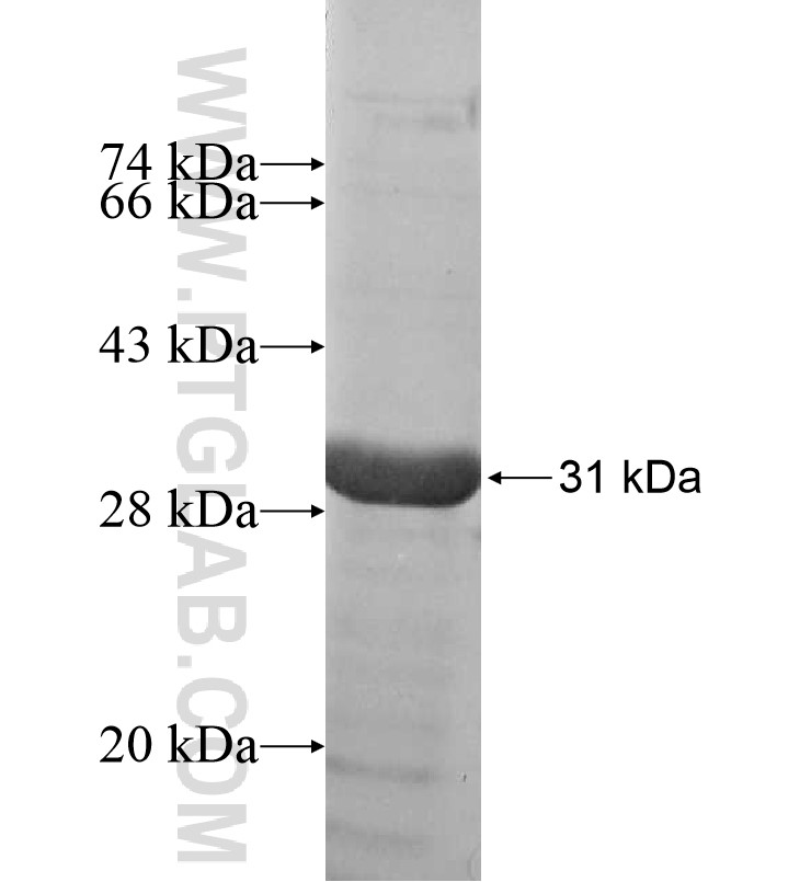 SLITRK5 fusion protein Ag16573 SDS-PAGE