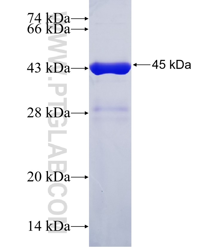 SLITRK6 fusion protein Ag34815 SDS-PAGE SLITRK6 fusion protein Ag34815 SDS-PAGE
