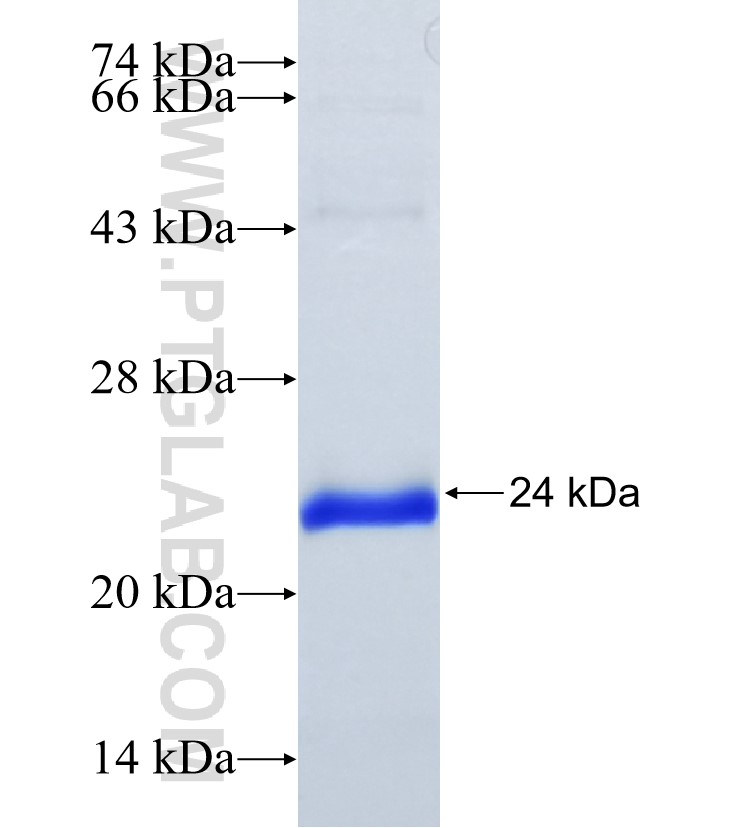 SLITRK6 fusion protein Ag34826 SDS-PAGE SLITRK6 fusion protein Ag34826 SDS-PAGE