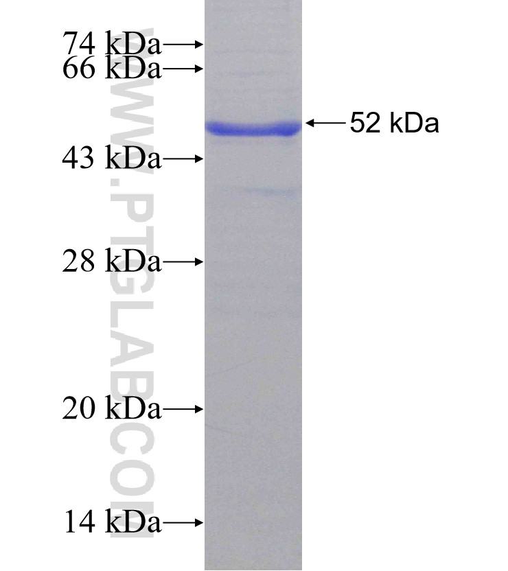 SLITRK6 fusion protein Ag15701 SDS-PAGE