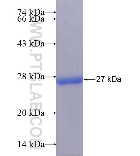 SLITRK6 fusion protein Ag16565 SDS-PAGE SLITRK6 fusion protein Ag16565 SDS-PAGE