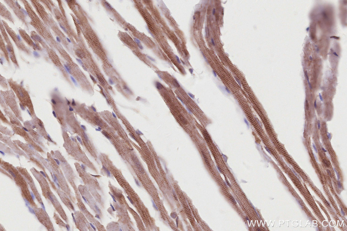 IHC staining of mouse heart using 19743-1-AP IHC staining of mouse heart using 19743-1-AP