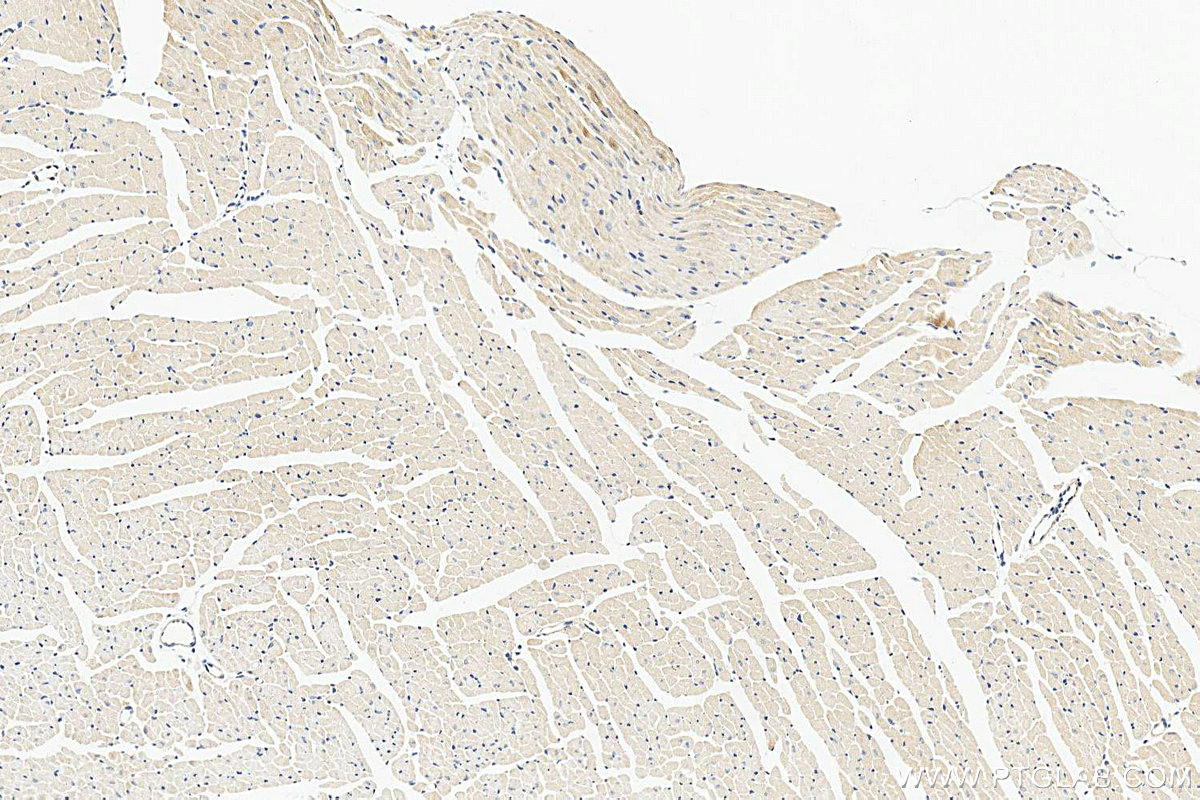IHC staining of mouse heart using 19743-1-AP (same clone as 19743-1-PBS) IHC staining of mouse heart using 19743-1-AP (same clone as 19743-1-PBS)