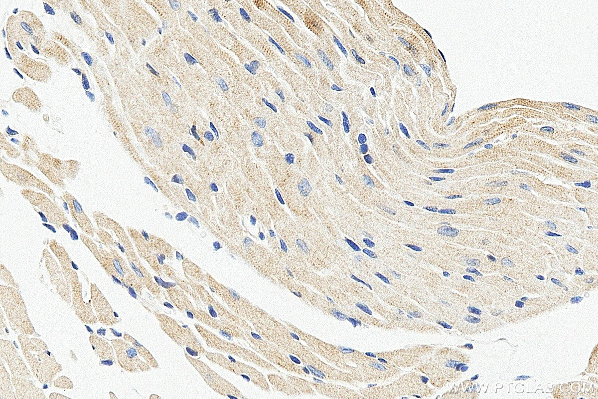 IHC staining of mouse heart using 19743-1-AP (same clone as 19743-1-PBS) IHC staining of mouse heart using 19743-1-AP (same clone as 19743-1-PBS)