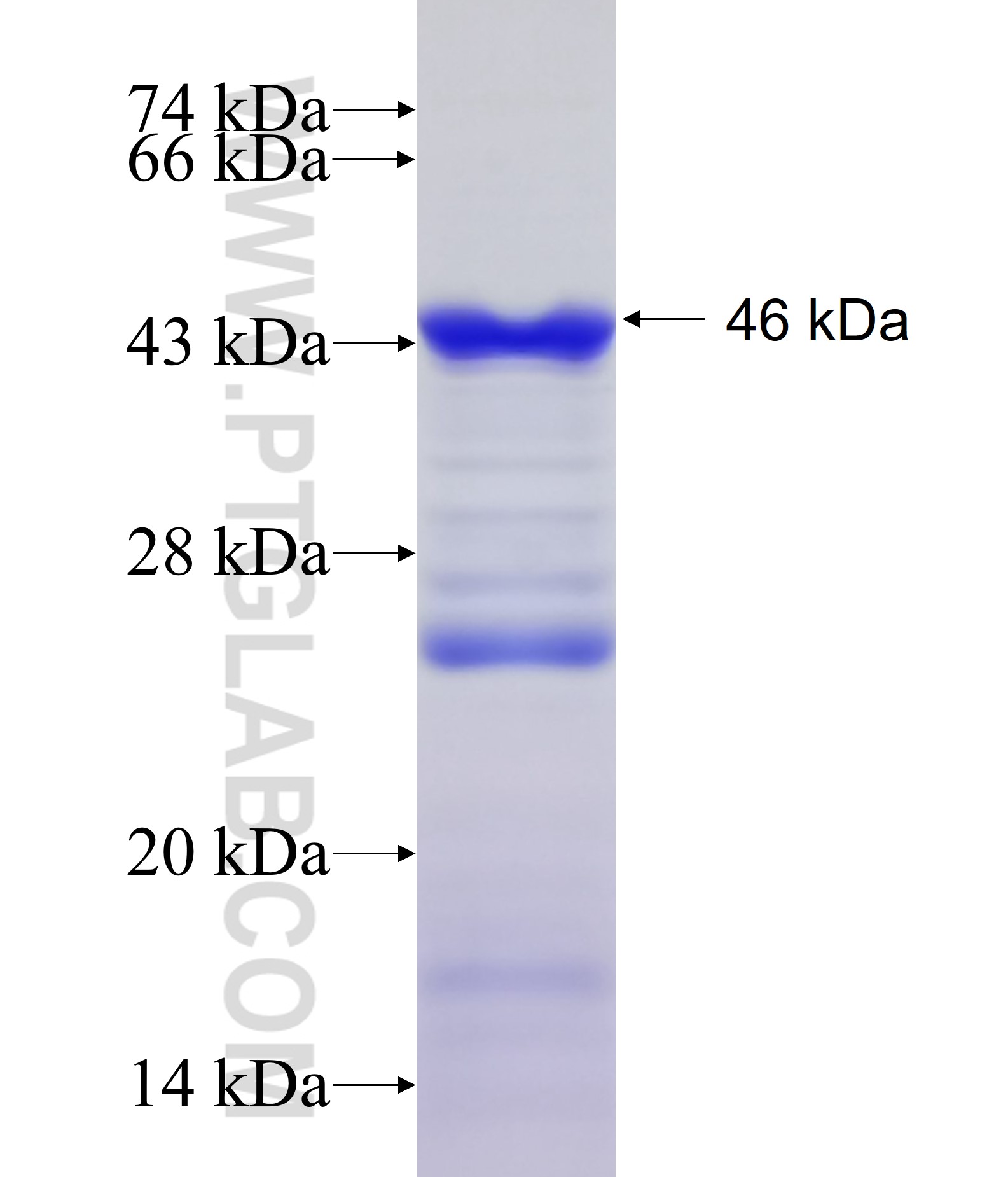 SLMAP fusion protein Ag18162 SDS-PAGE