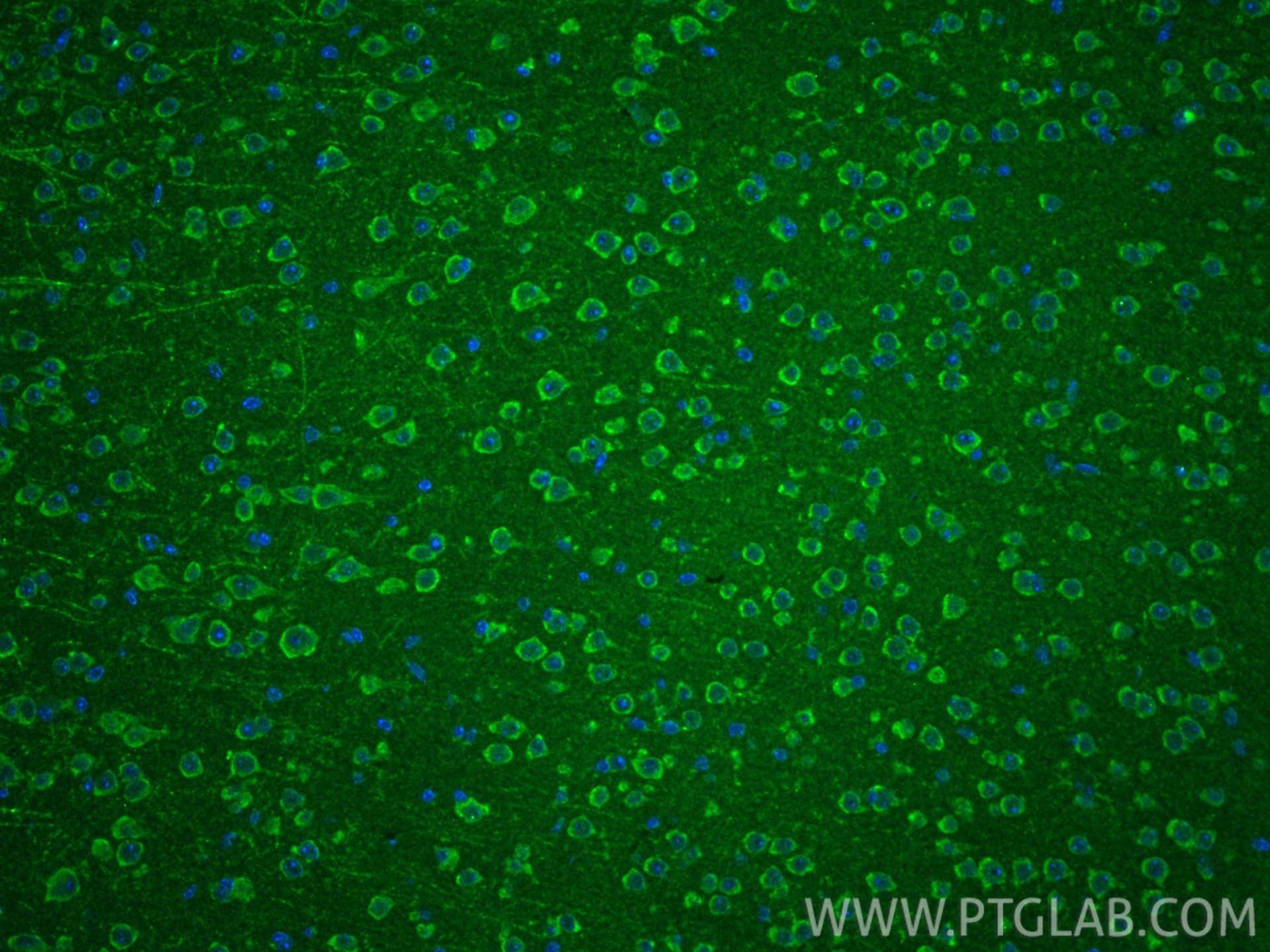 IF Staining of mouse brain using 25065-1-AP IF Staining of mouse brain using 25065-1-AP