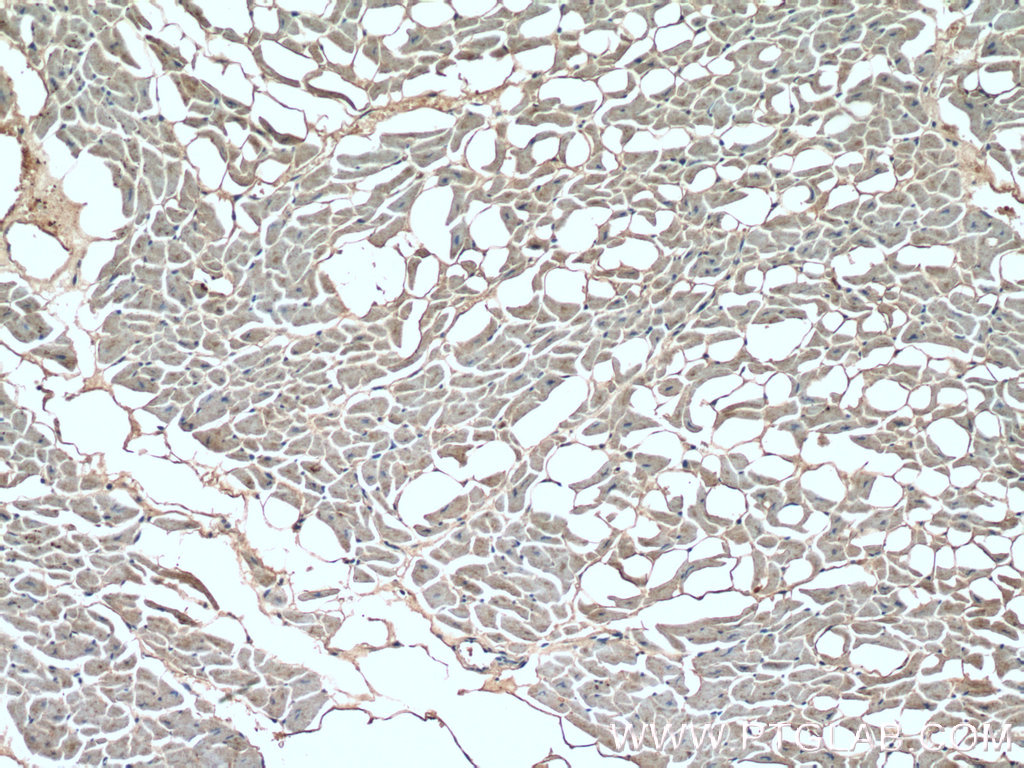 IHC staining of human heart using 18395-1-AP