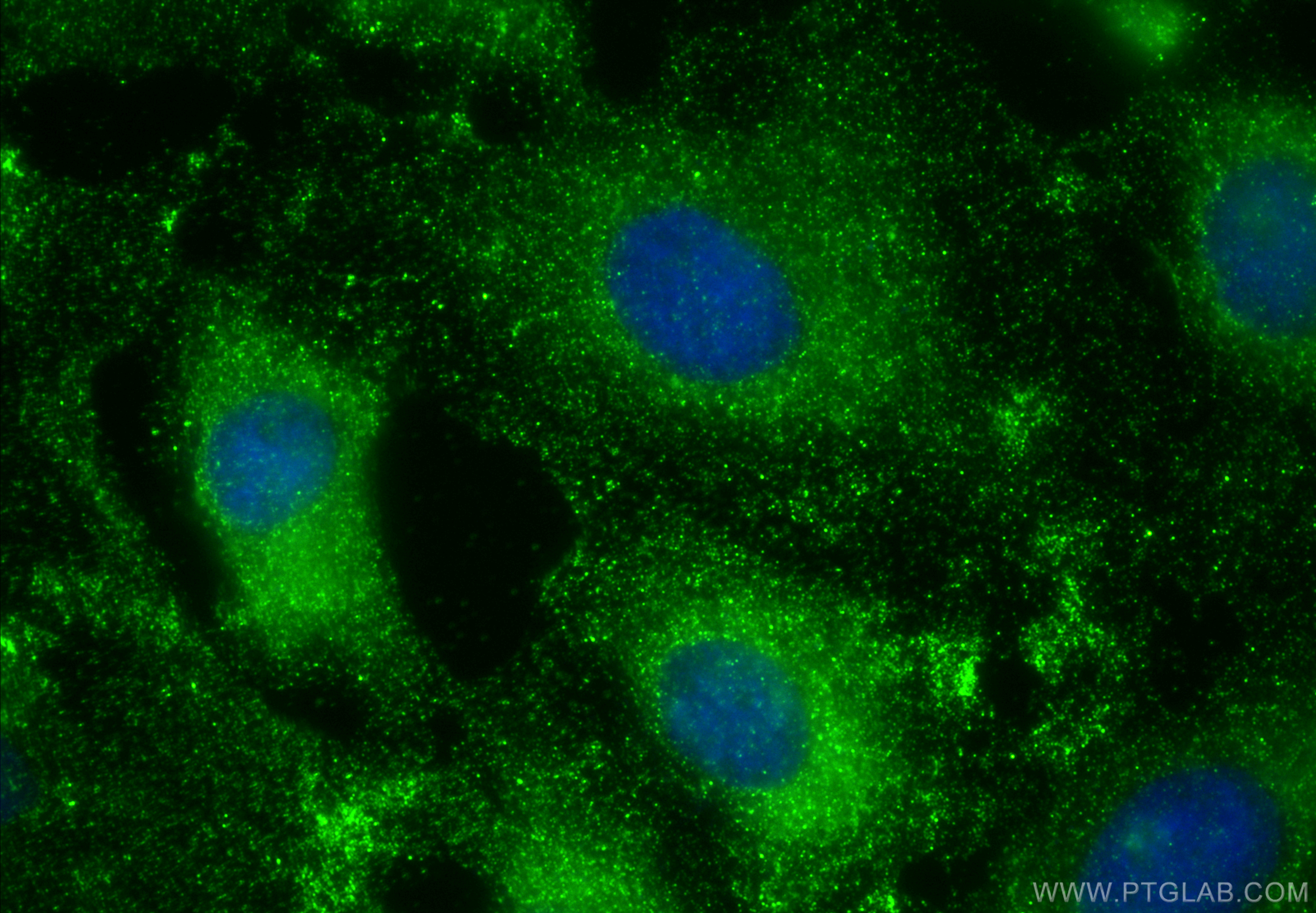 IF Staining of HeLa using 66465-1-Ig