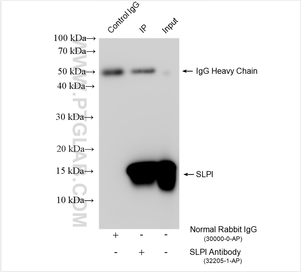 IP experiment of human saliva using 32205-1-AP