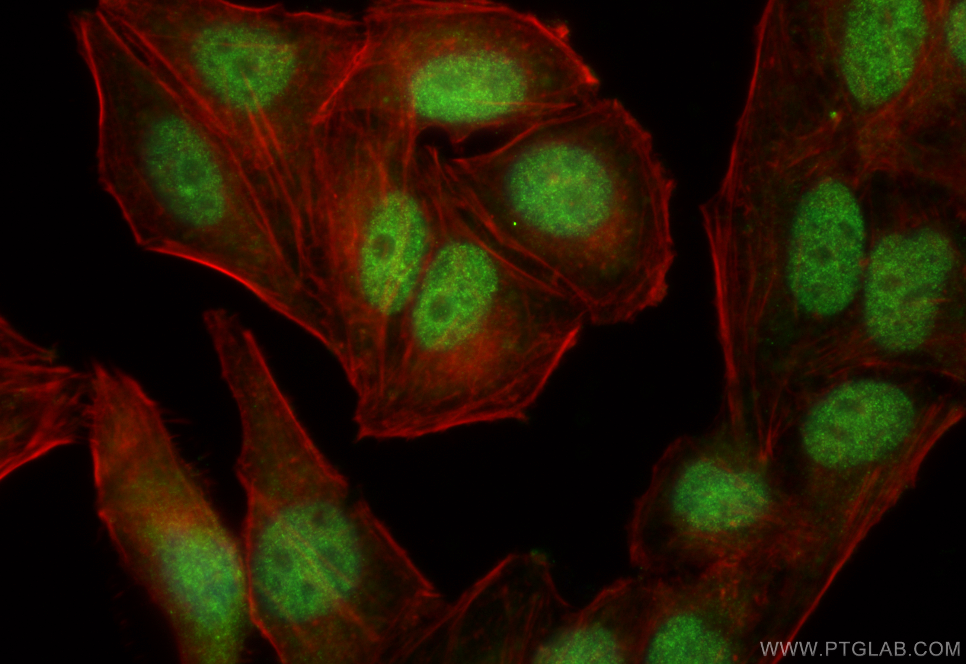 IF Staining of HepG2 using 17889-1-AP