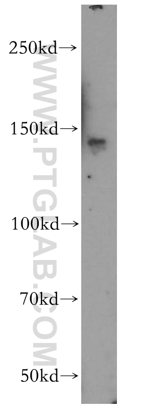 WB analysis of mouse brain using 17889-1-AP